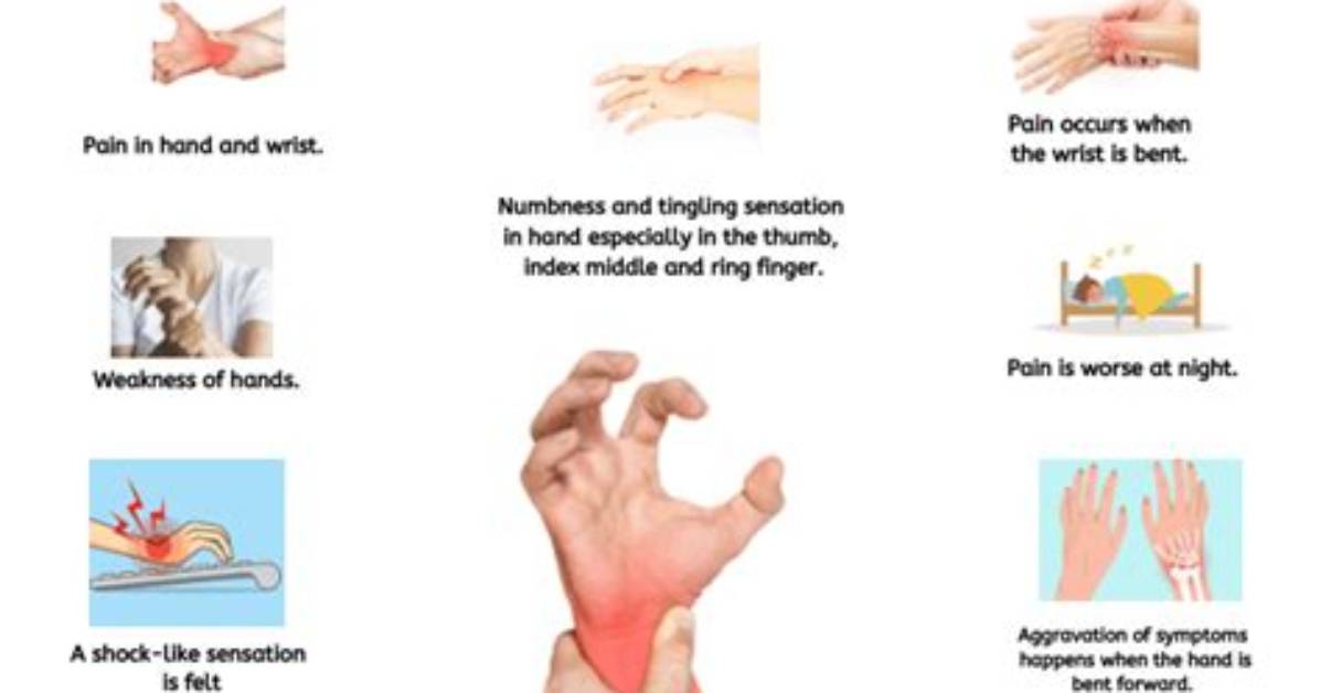 What Are the Five Symptoms of Carpal Tunnel Syndrome?