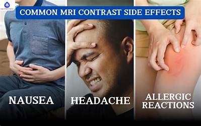 What Are the Side Effects of Contrast Dye?