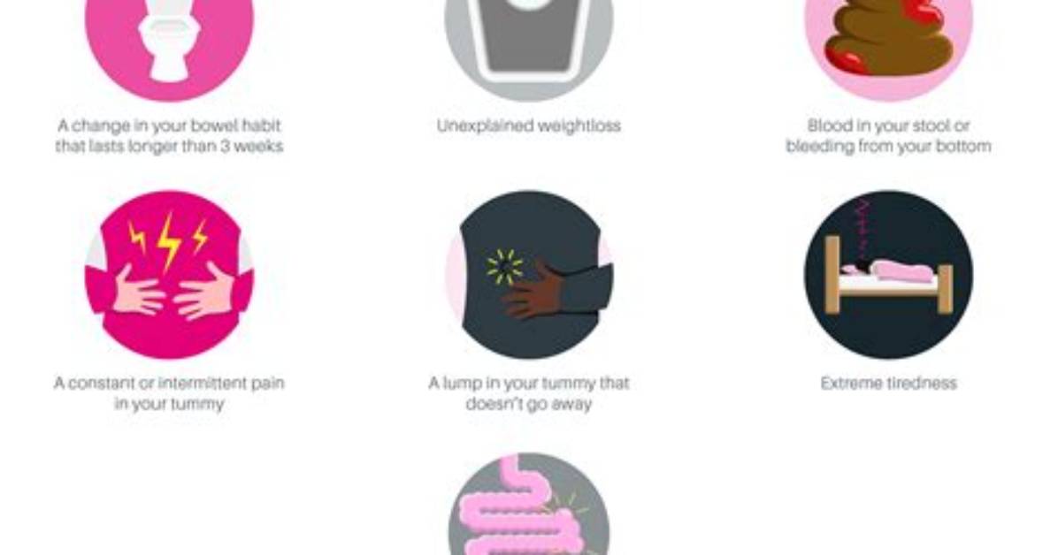 What Are the Symptoms of Bowel Cancer?
