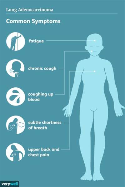 What Are the Symptoms of Lung Adenocarcinoma?