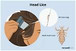What Can Lice Do to You?