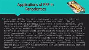 What Can Prf Funds Be Used for?