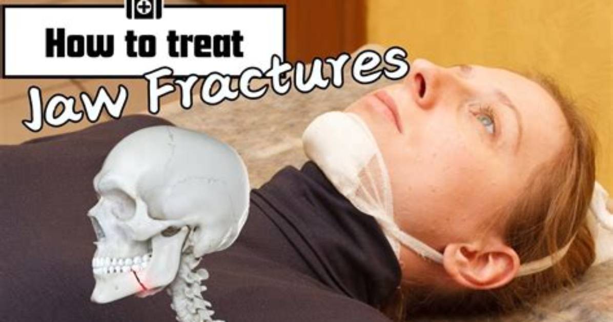 What Can You Eat with Broken Jaw?