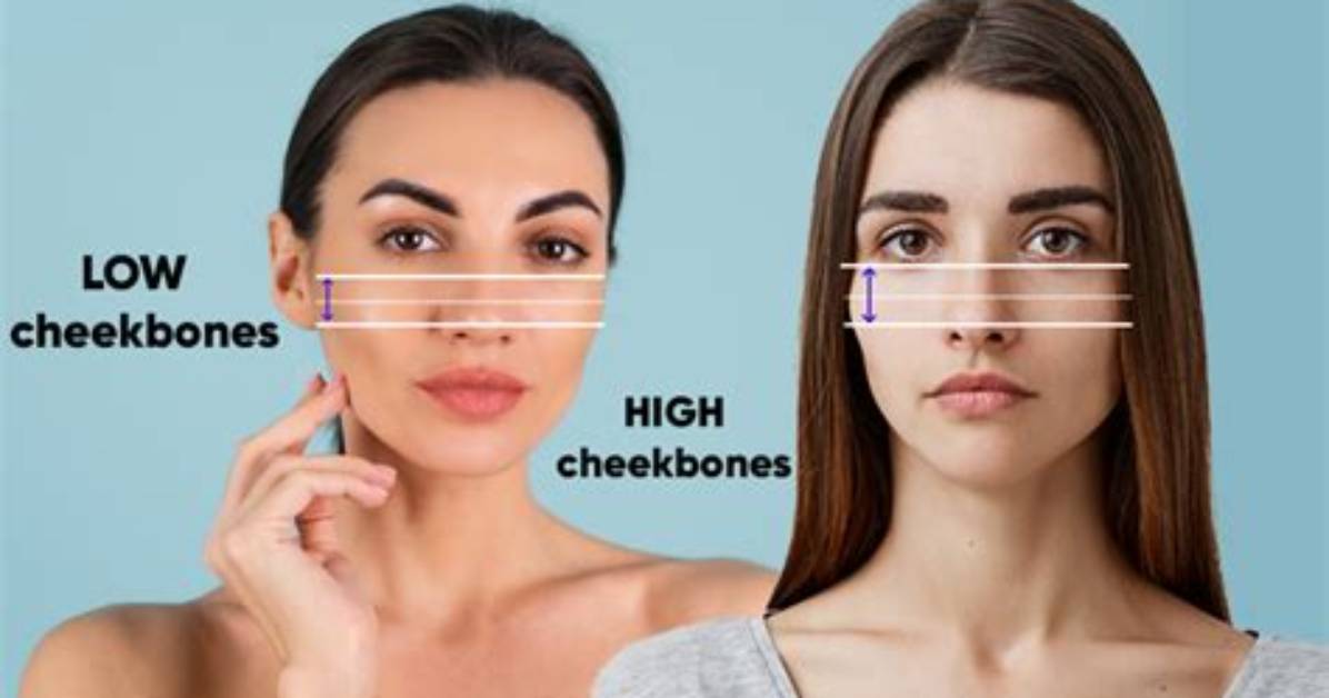 What Causes High Cheekbones?