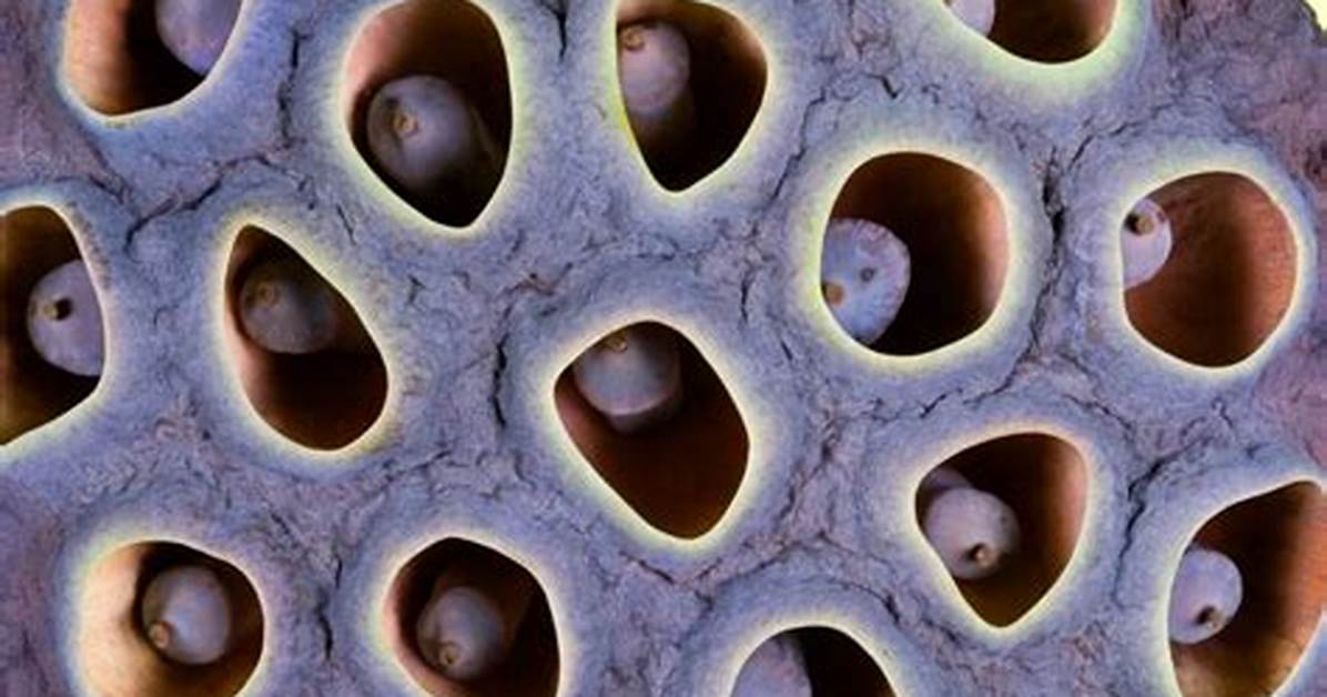 What Causes Holes In