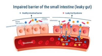 What Causes Leaky Gut?