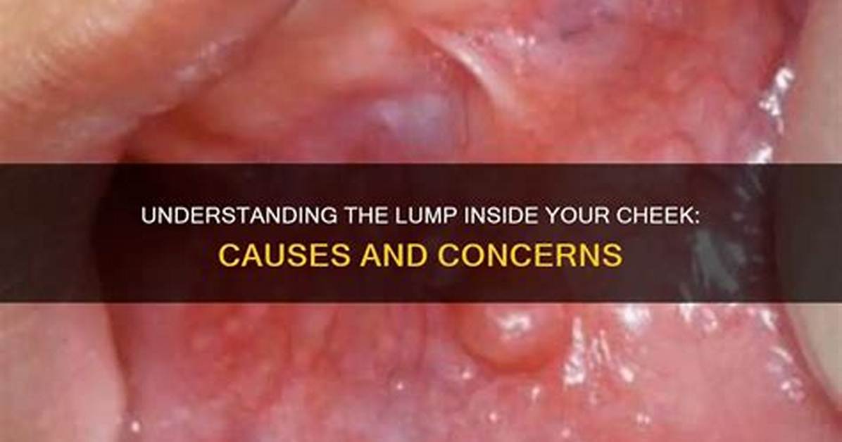 What Causes Lump Inside Cheek?