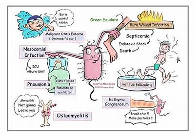 What Causes Pseudomonas Infection?