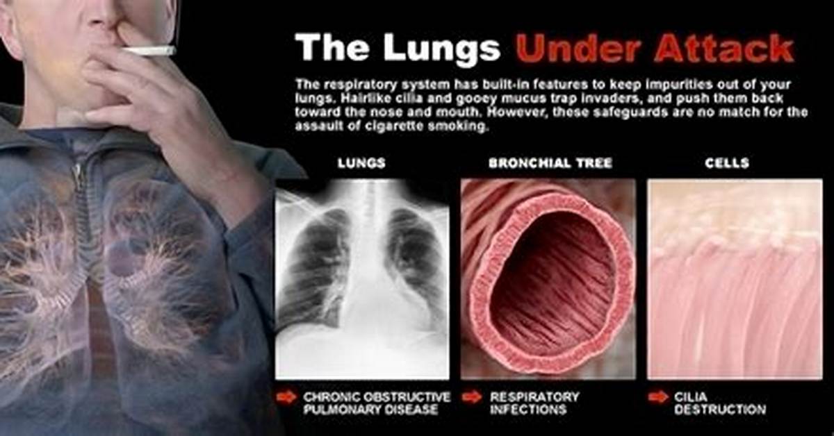 What Causes the Lungs to Fail?