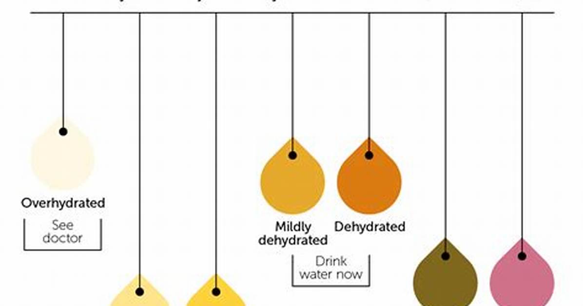 What Color Is Your Pee When Your Liver Is Failing?