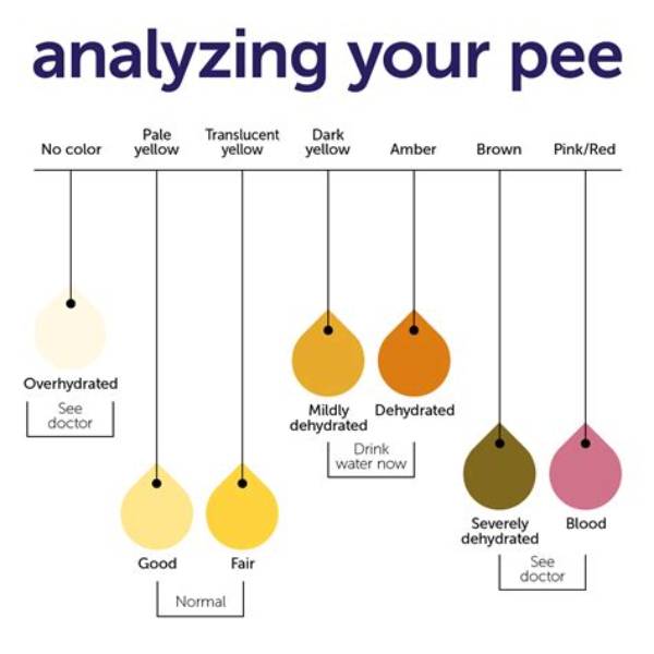 What Color Is Your Pee When Your Liver Is Failing?