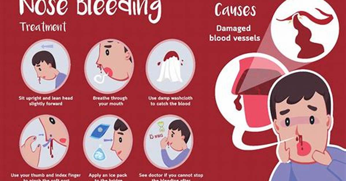 What Color Should a Nosebleed Be?
