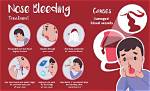 What Color Should a Nosebleed Be?