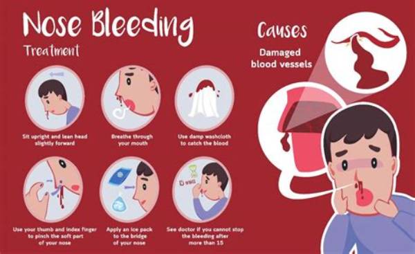 What Color Should a Nosebleed Be?