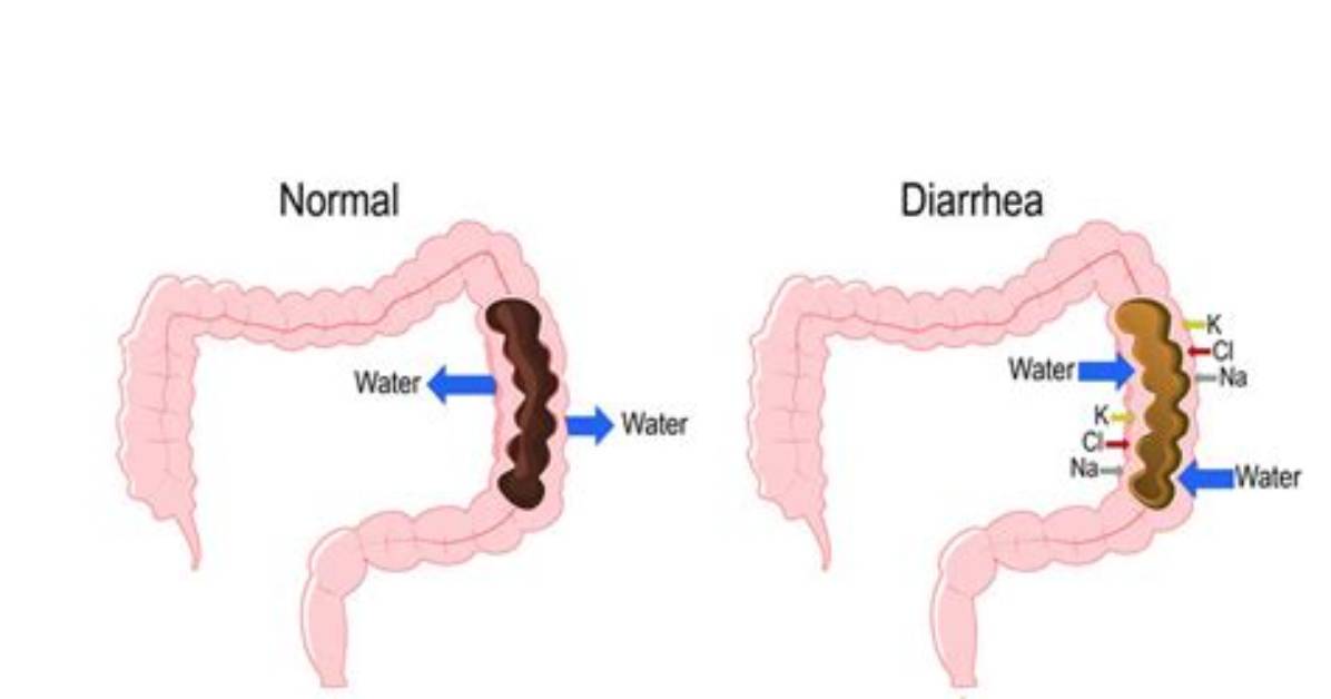 What Diarrhea Means?