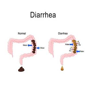 What Diarrhea Means?