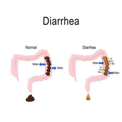 What Diarrhea Means?