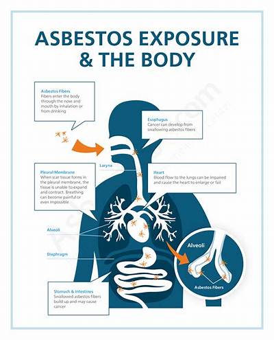 What Diseases Can Be Caused by Asbestos?