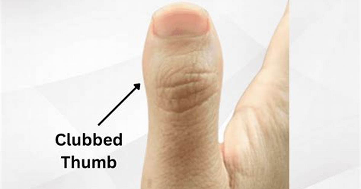 What Do Long Thumbs Indicate?