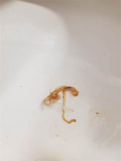 What Do Tongue Worms Look Like?