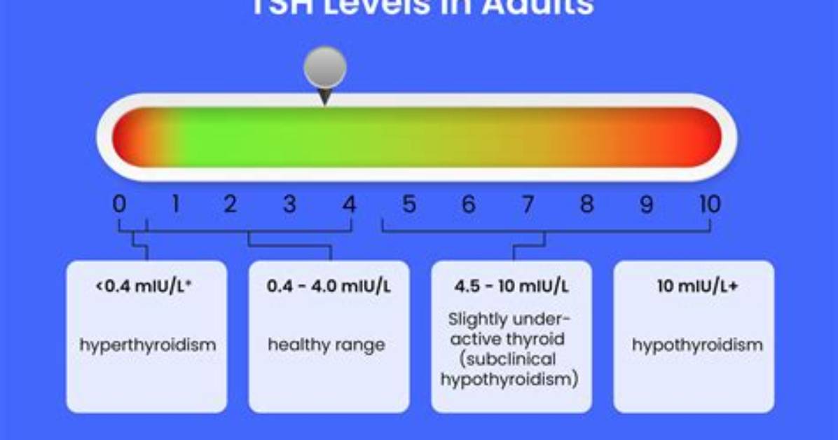 What Does a Tsh of 20 Mean?