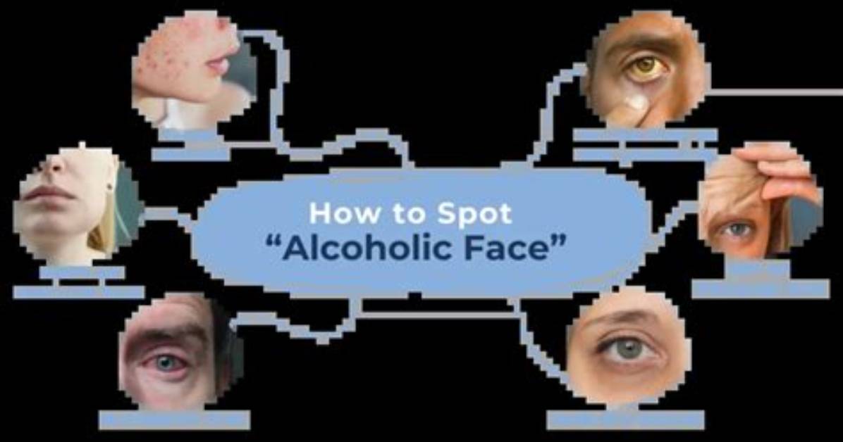 What Does Alcohol Do to Your Face?