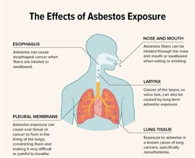 What Does Asbestos Poisoning Cause?