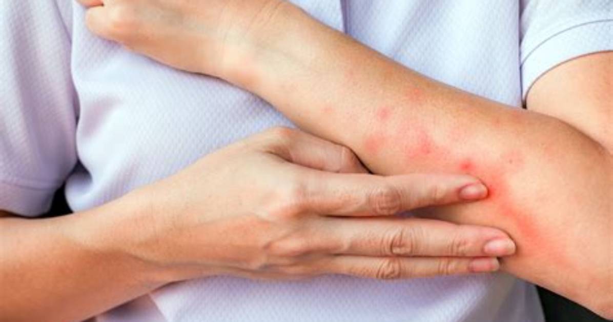 What Does Bite Your Arm off Mean?