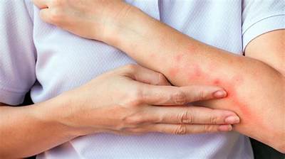 What Does Bite Your Arm off Mean?