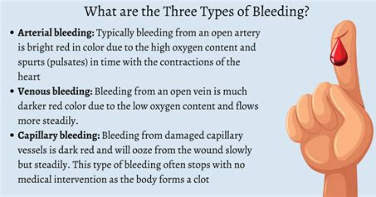 What Does Bleeding out Mean