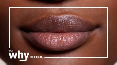 What Does Cinnamon Do to Lips?