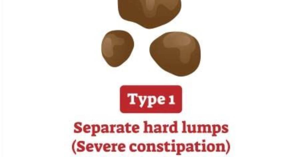 What Does Foul-Smelling Diarrhea Mean?