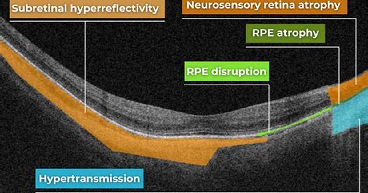 What Does Neurosensory Mean?