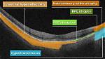 What Does Neurosensory Mean?