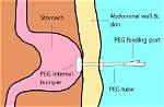 What Does Peg Stand for in the Army?