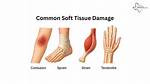 What Does Soft Tissue Damage Feel Like?