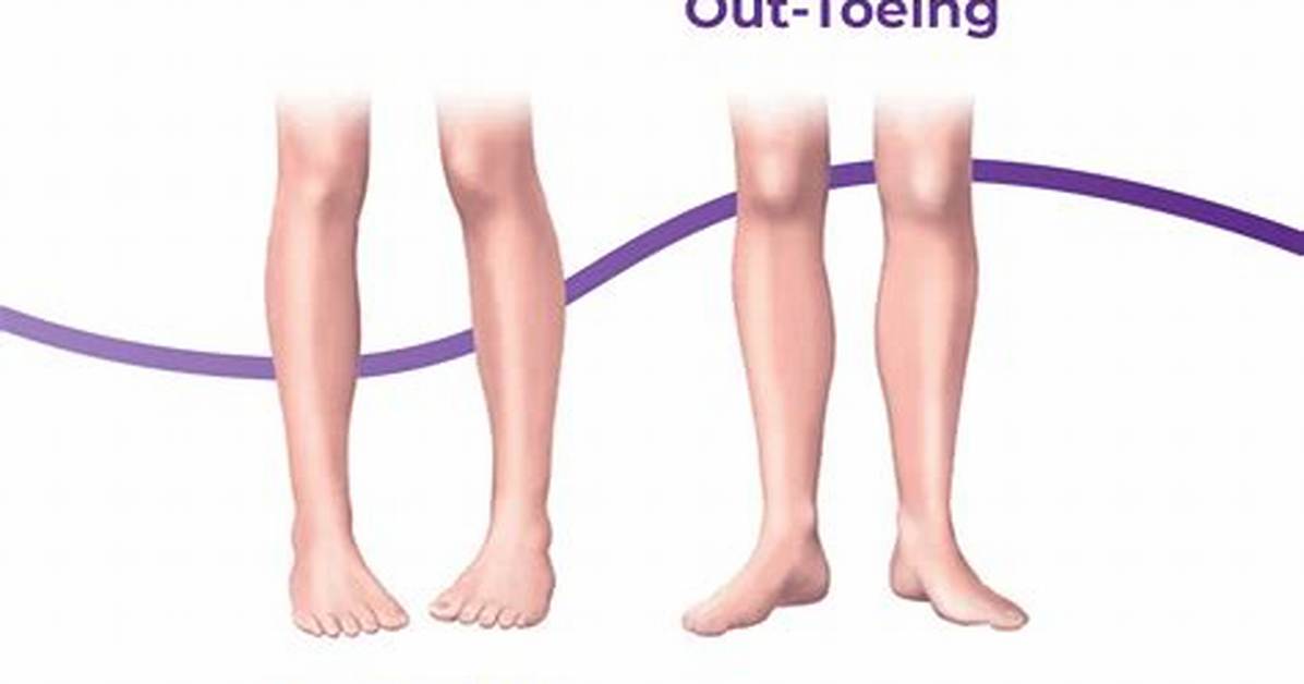 What Does Toeing the Line Mean?