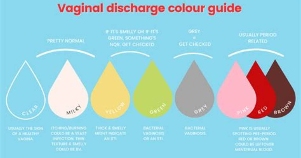 What Does White Discharge Mean?