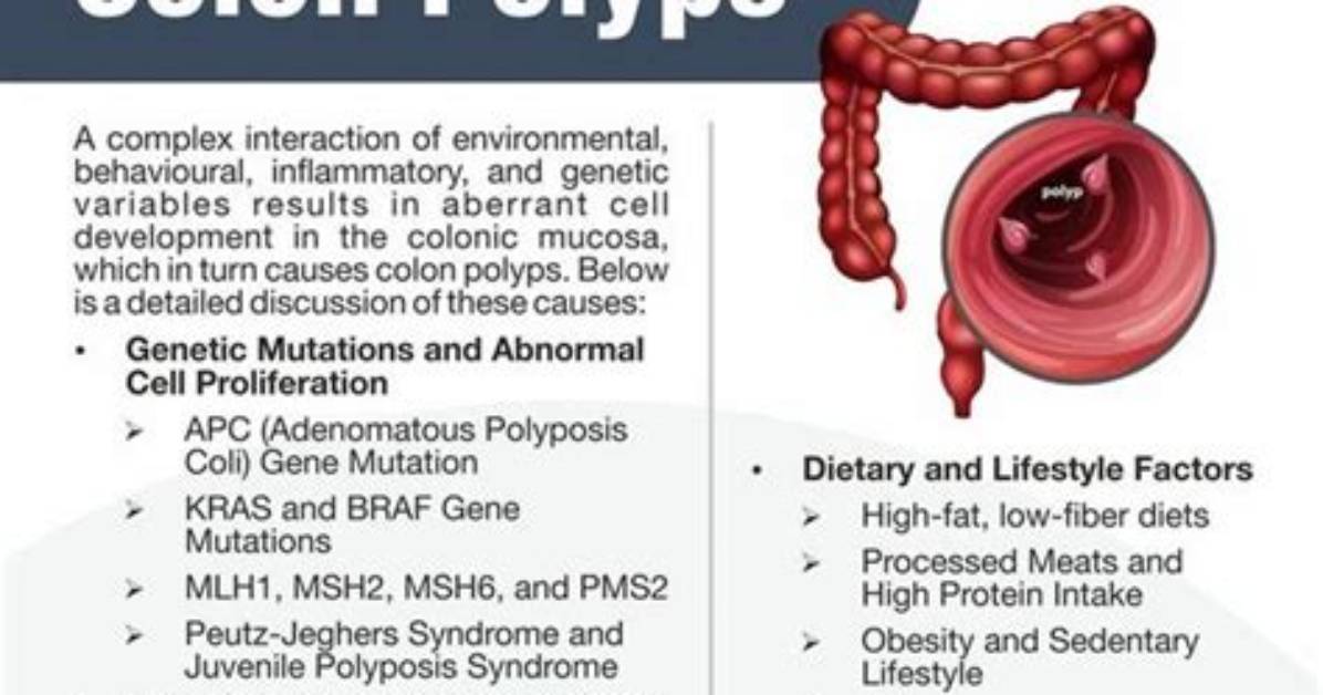 What Food Causes Polyps in the Colon?
