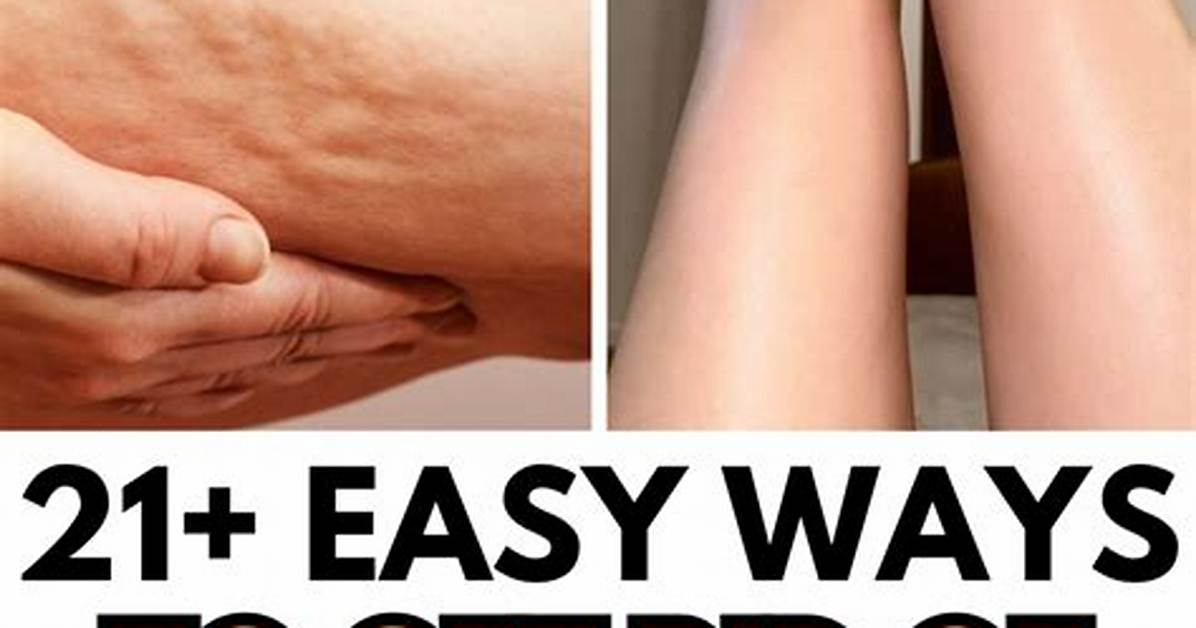 What Gets Rid of Cellulite Naturally?