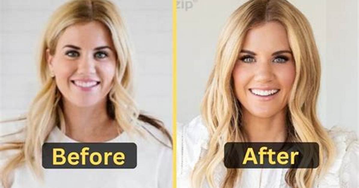 What Happened to Shea Mcgee Teeth Did the Dream Home Makeover Cast Have Surgery in Her
