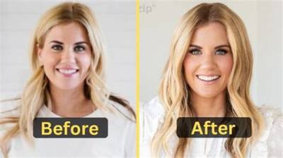 What Happened to Shea Mcgee Teeth? Did the Dream Home Makeover Cast Have Surgery in Her Mouth