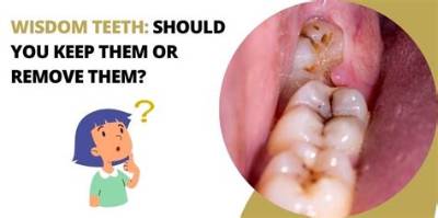 What Happens If I Keep My Wisdom Teeth?