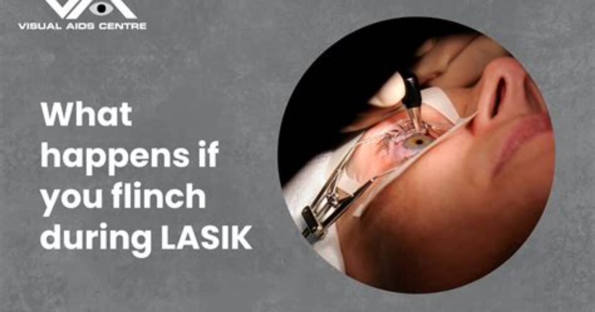 What Happens If You Blink During Lasik Surgery?
