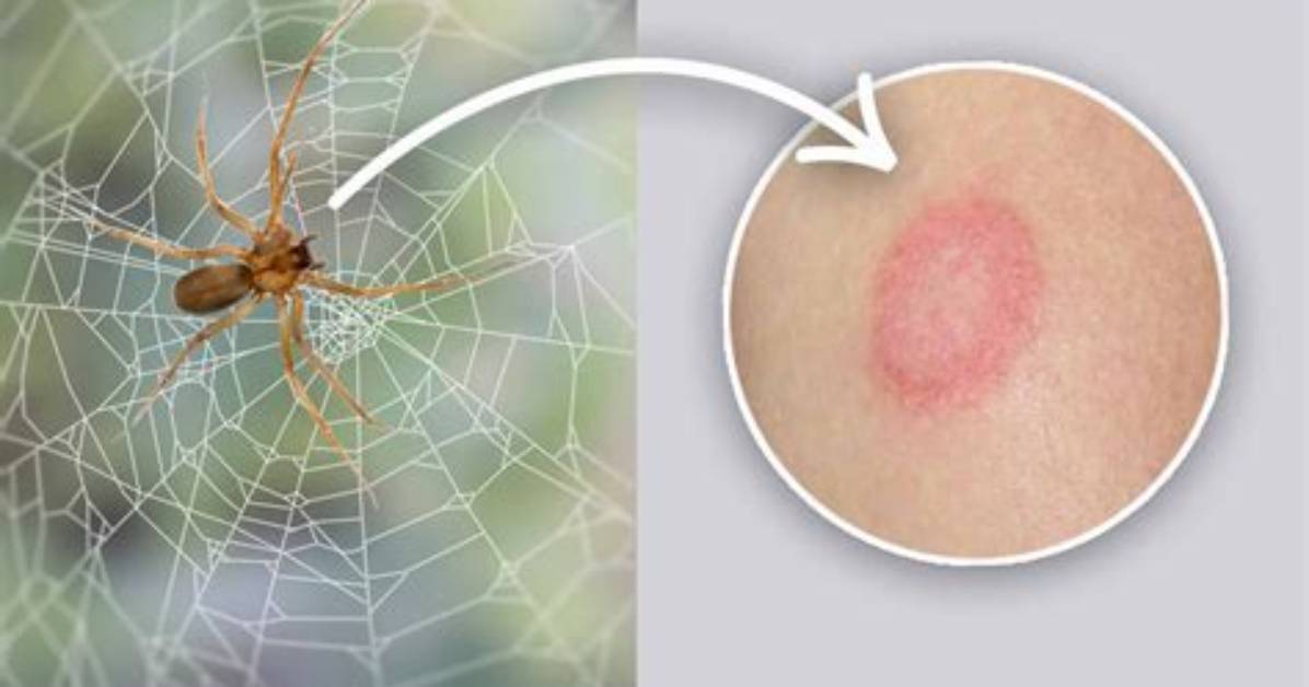 What Happens If You Boil a Spider?