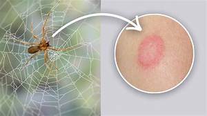 What Happens If You Boil a Spider?