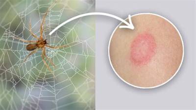 What Happens If You Boil a Spider?