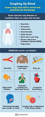 What Happens If You Cough While Under Anesthesia?