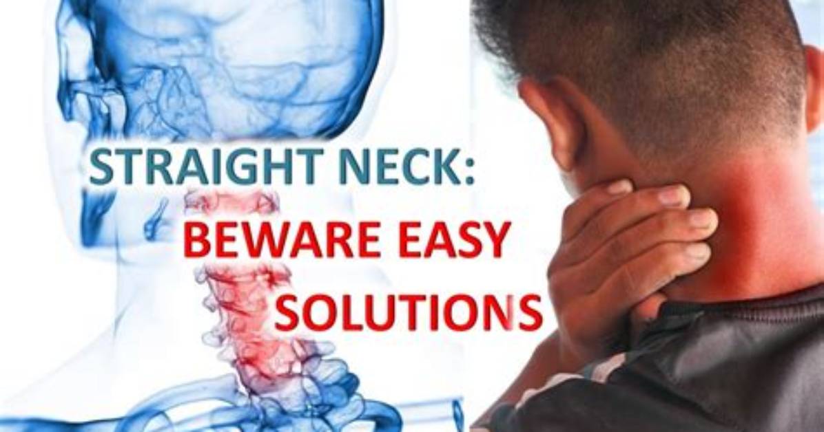 What Happens If Your Neck Is Straight Instead of Curved?