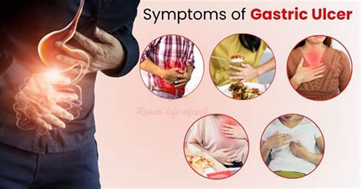 What Helps Stomach Ulcer Pain at Night?